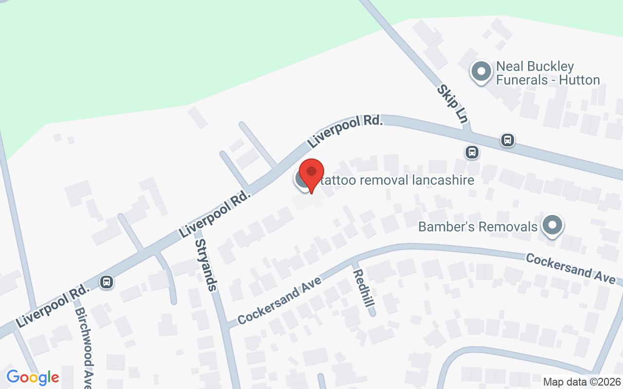 Map showing the location of Diamond Lipo